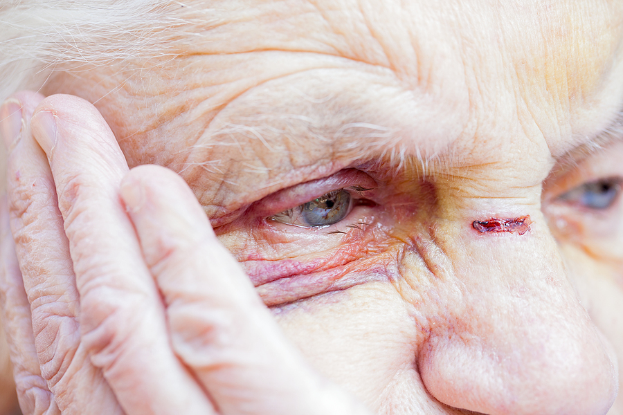 What is the most common injury in a nursing home